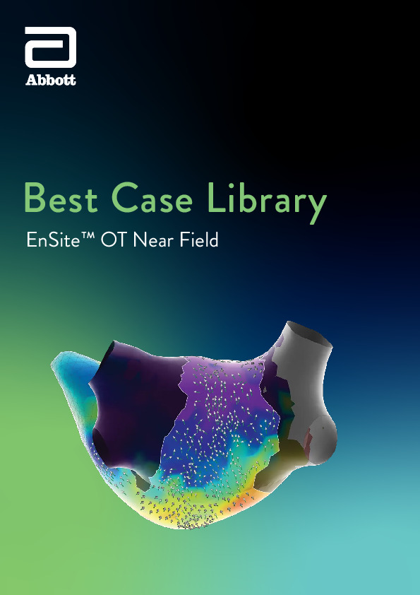 Cover thumbnail of EnSite OT Near Field Base Case Library