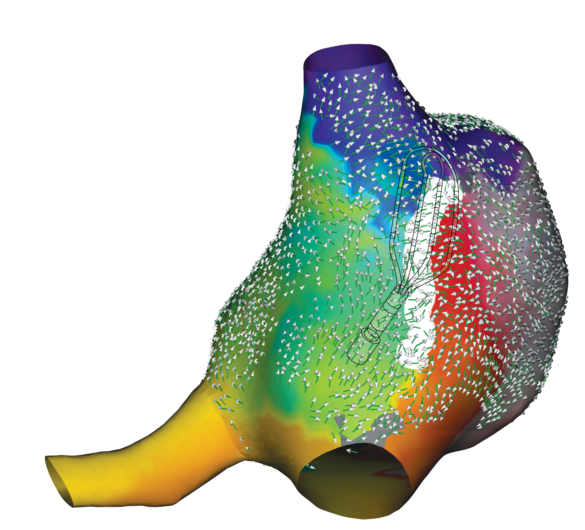 ep-ensite-otnf-atrialmap-png.png