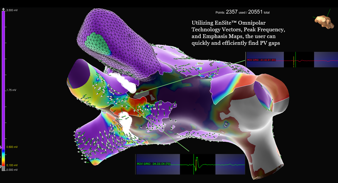 ep-ensite-otnf-map.png